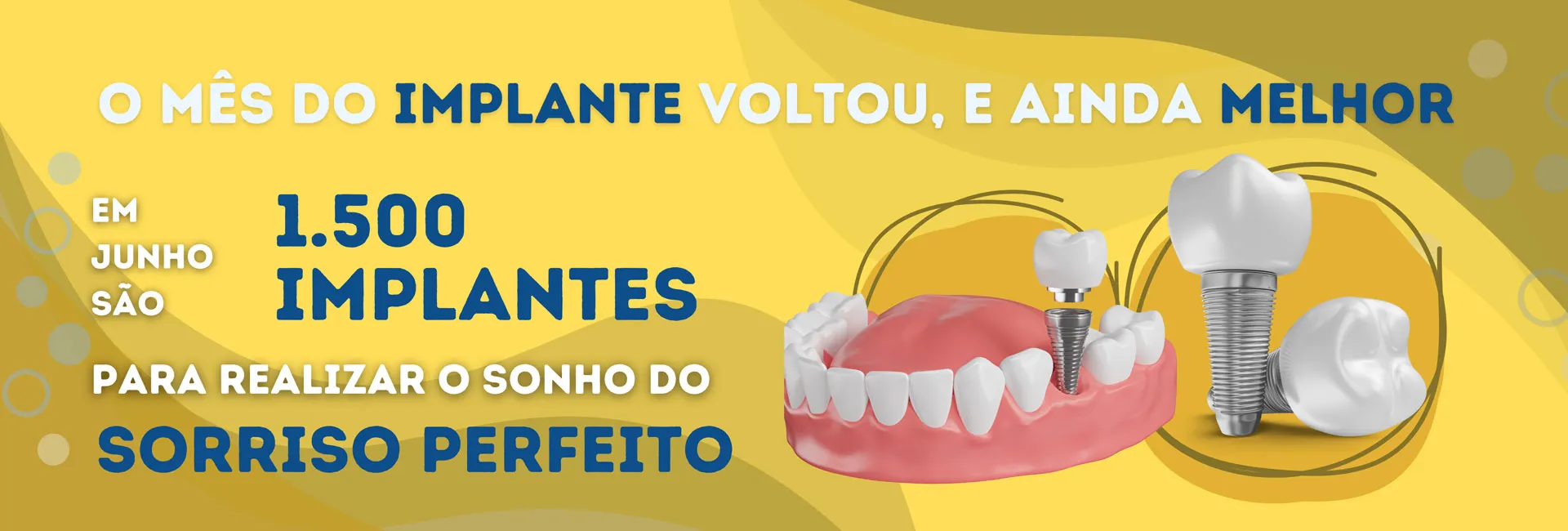 Mês do Implante New Life Odontologia