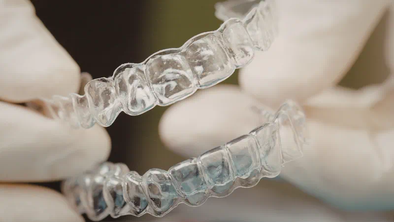 Alinhadores - New Life Odontologia