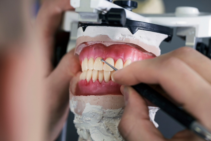 Próteses Dentárias em Curitiba: Recuperando o Sorriso com Estilo e Conforto