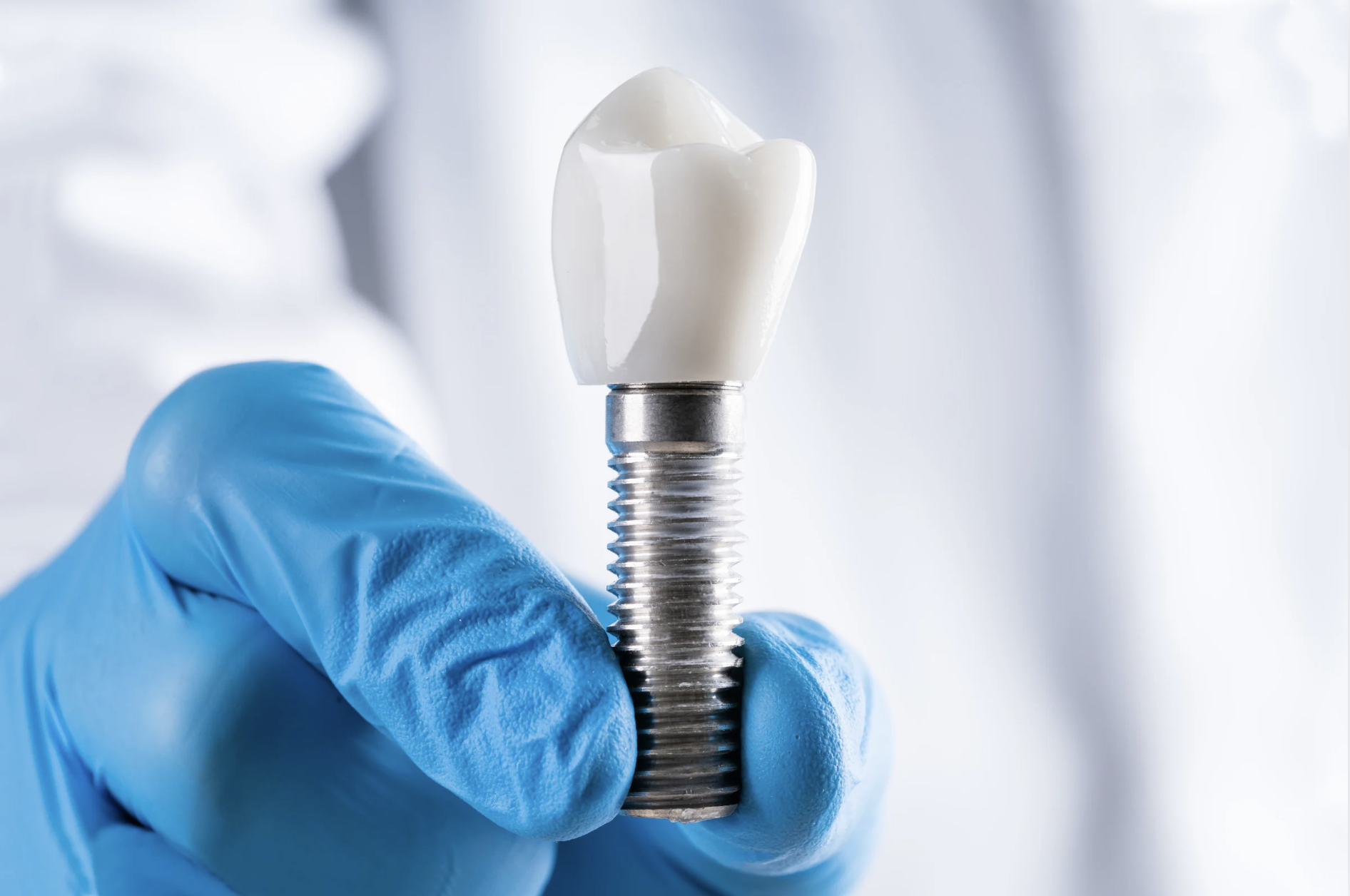 Implantes Dentários em Curitiba: Recuperando Sorrisos e Qualidade de Vida