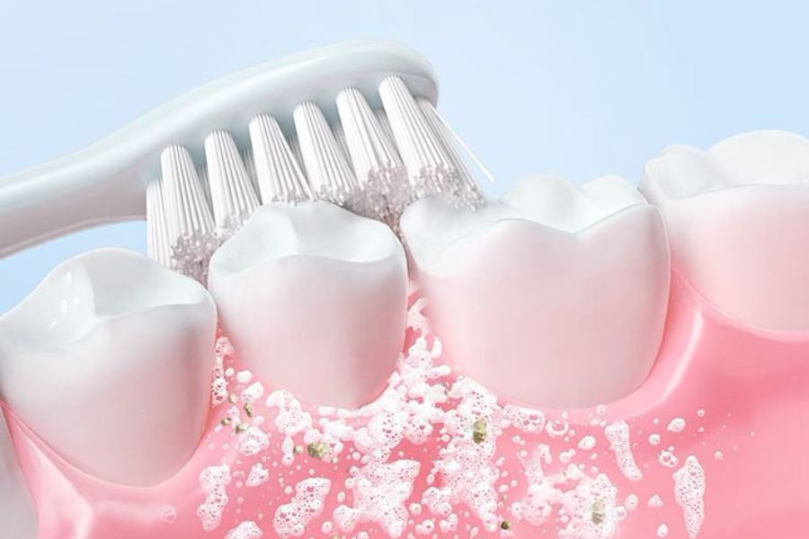 Implante Dentário Curitiba